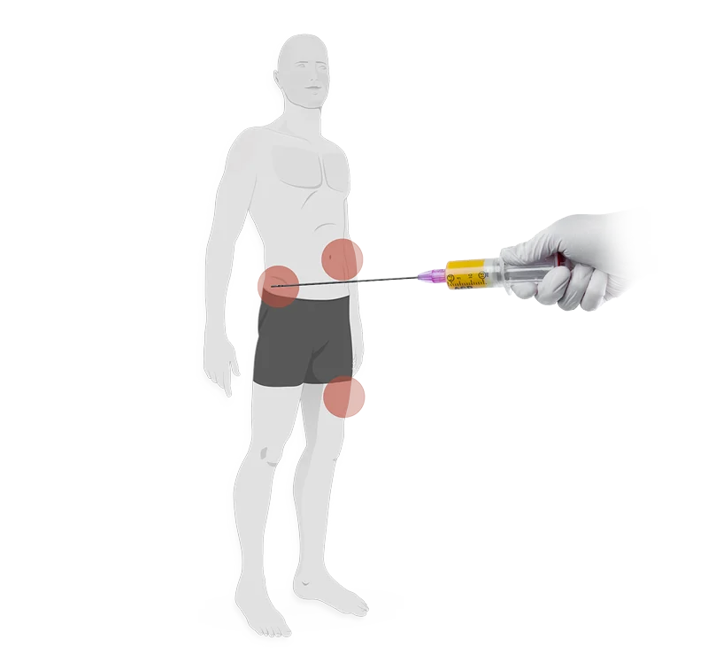 Stromal Vascular Fraction (SVF)